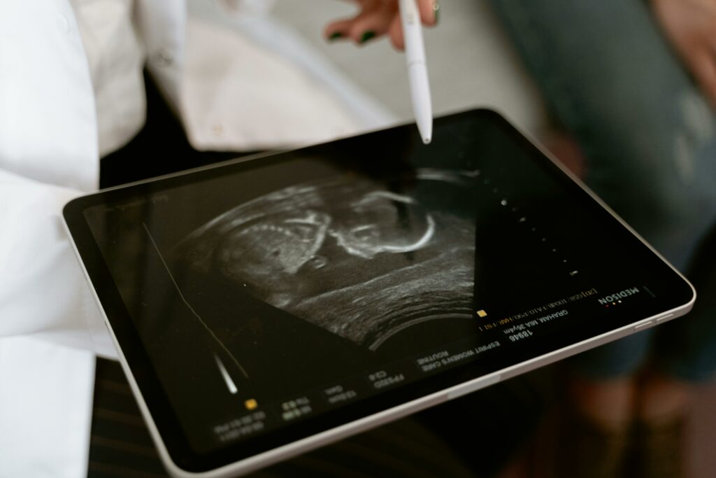 Peut-on faire une échographie pour diagnostiquer la NASH ?